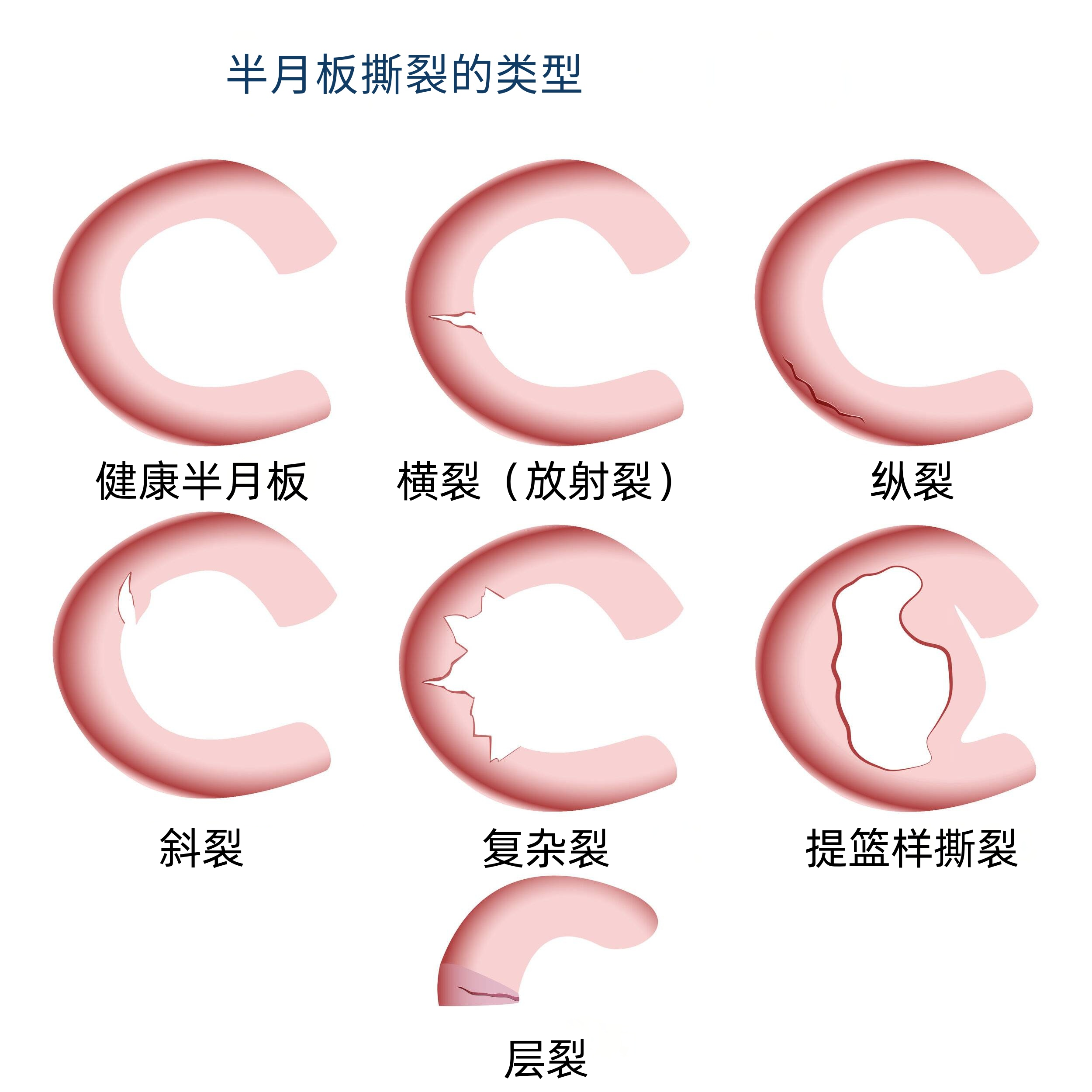 uploads/image/20240914/1726296720.png
